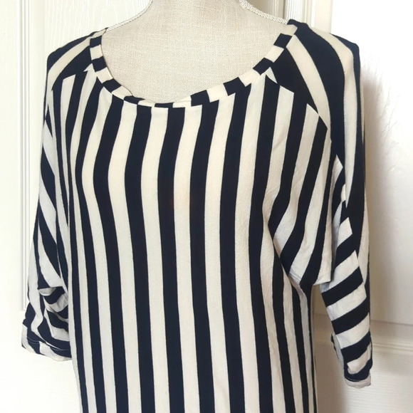 Diesel Black and White Stripe Dress - Picture 2 of 5